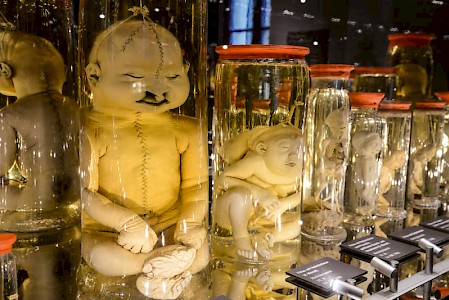Die Humanpräparate stammen aus dem 18. Jahrhundert.