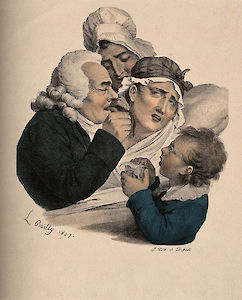 Ein übermäßiger Aderlass sollte den Eintritt des Todes beschleunigen helfen. Zeichnung von Louis Boilly, 1827, nach einem Motiv von François-Séraphin Delpech