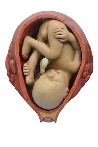 Leibesfrucht im 7. Monat. Wachs, Lehrmittel DHMD, 1950–1970